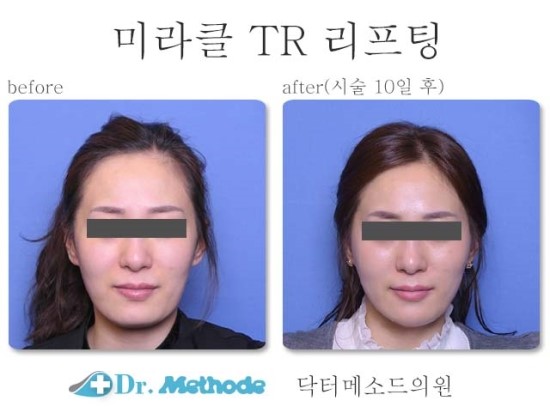 나비피부과의원 이미지