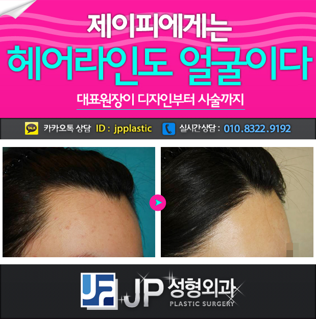 정 헤어라인 이미지