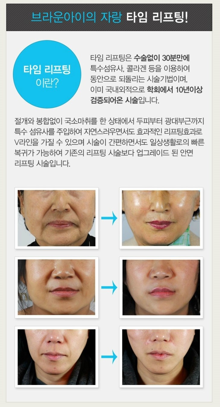 브라운아이의원 이미지