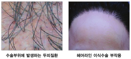 엠지에프두피탈모센터 이미지