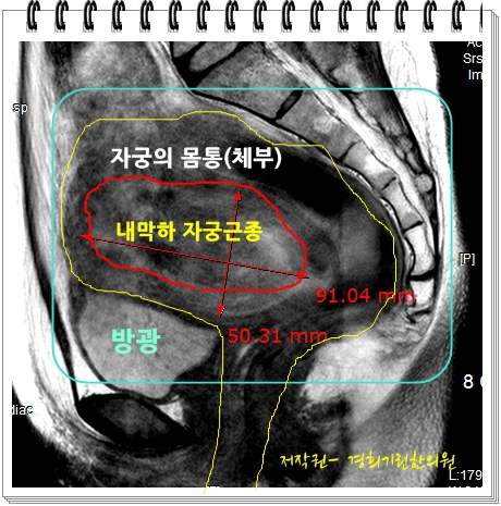 중앙수예 이미지