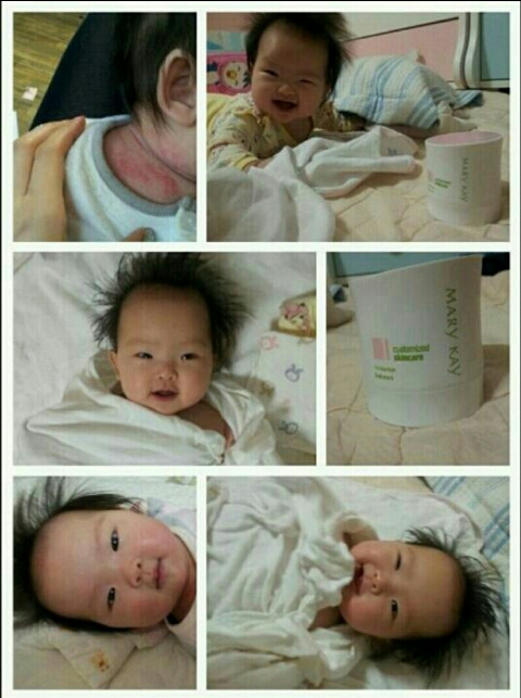 케이커스트 이미지