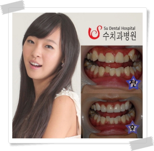 서울수치과 이미지