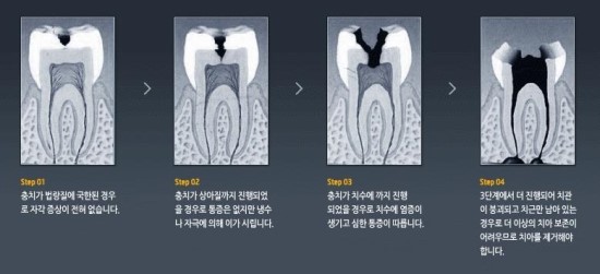 이오플러스 이미지