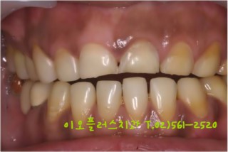 이오플러스 이미지