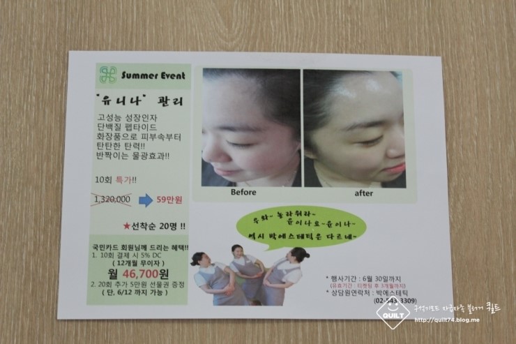 유니나 피부관리 이미지