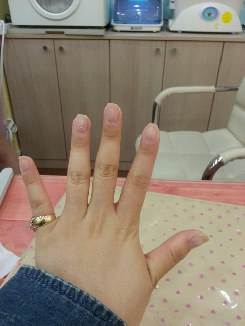 빨강이 손톱 이미지