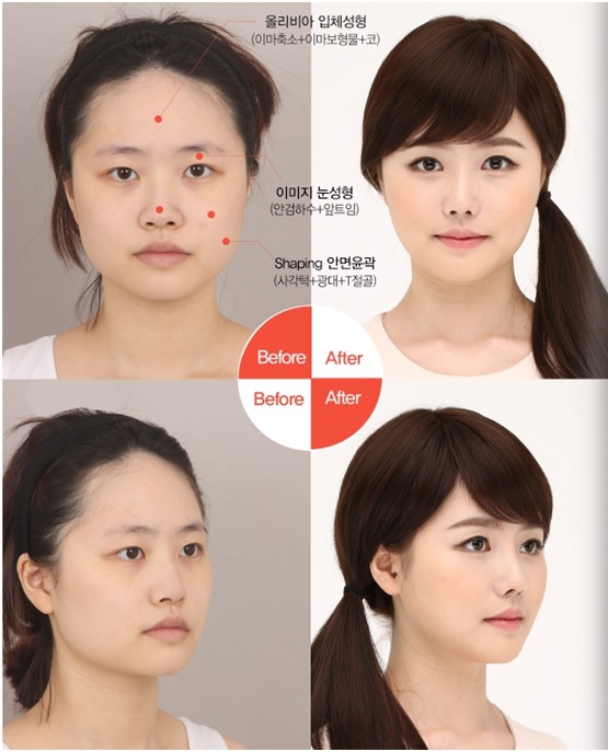 렛미인 이미지