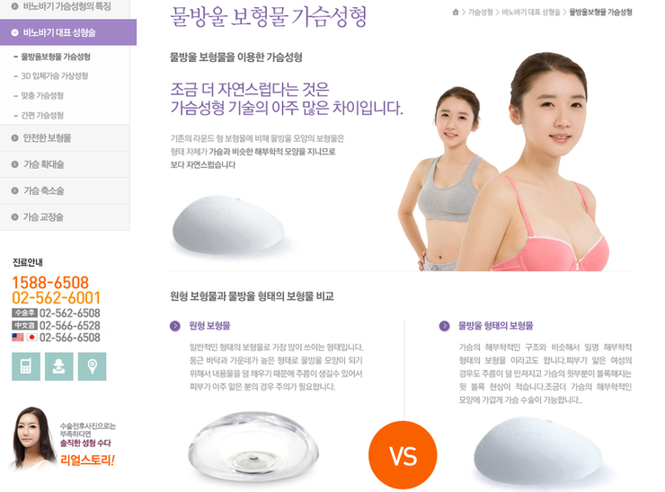 바노바기 성형외과 이미지