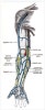Arteriovenous access (AVF and AVG) : 네이버 블로그