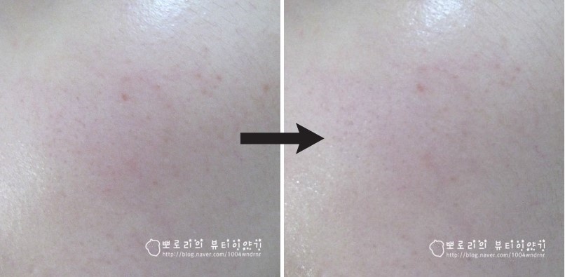 디케이스킨 이미지