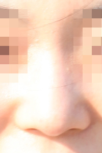 장익수성형외과 이미지