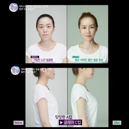 렛미인헤어 이미지
