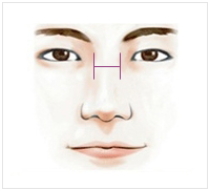 청담윤 이미지