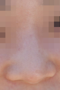 장익수성형외과 이미지