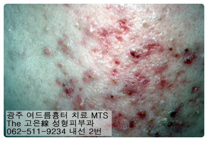 the,고은 이미지