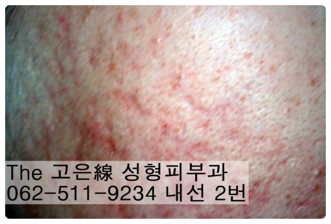 the,고은 이미지
