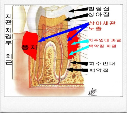 청라리더스치과 이미지