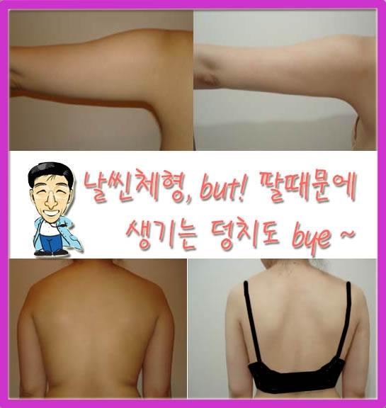 팔뚝갈비 이미지