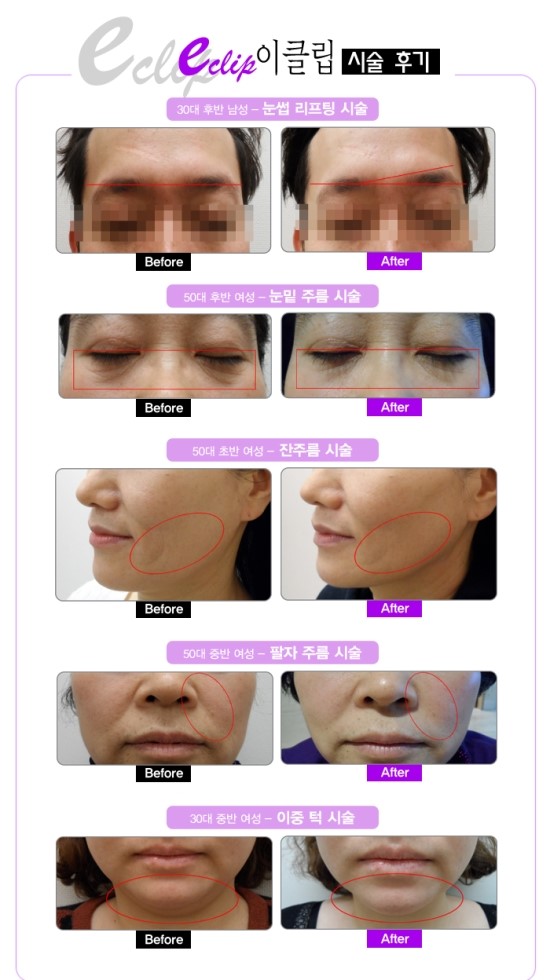 뷰티시크릿가든 이미지