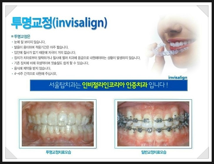 서울탑치과 이미지