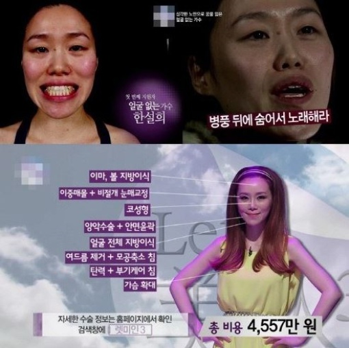 렛미인피부 이미지