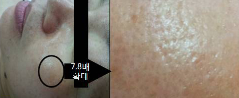 피부관리콜 이미지