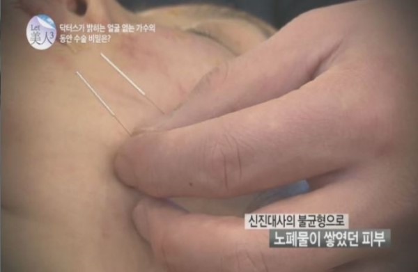 렛미인피부 이미지