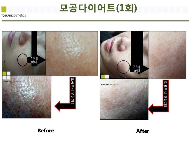 진피부샵 이미지