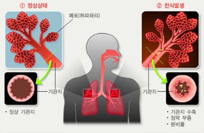 진소아 이미지