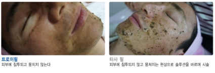 예인피부관리 이미지