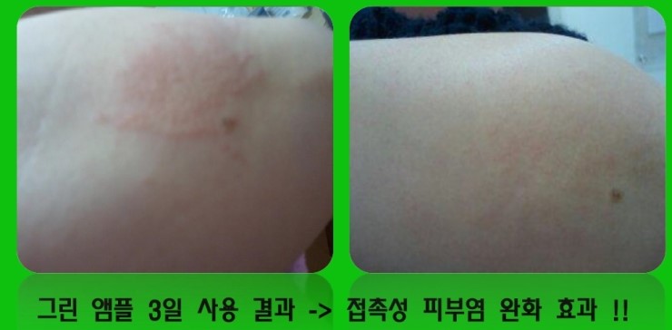 예인피부관리 이미지