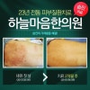 습진치료법→습진을 치료하는 →습진치료법!! : 네이버 블로그