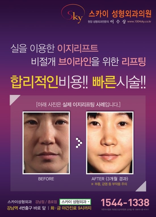 이지성형외과 이미지