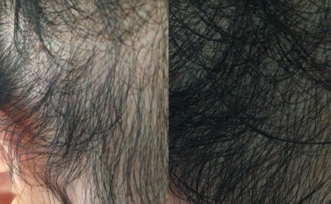 윈윈헤어 이미지