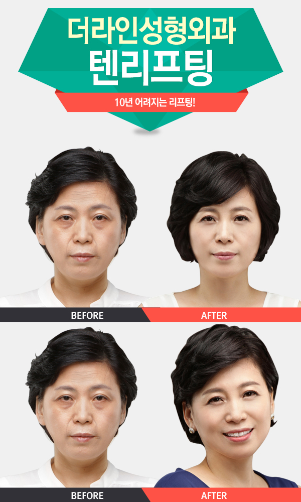 더라인 이미지
