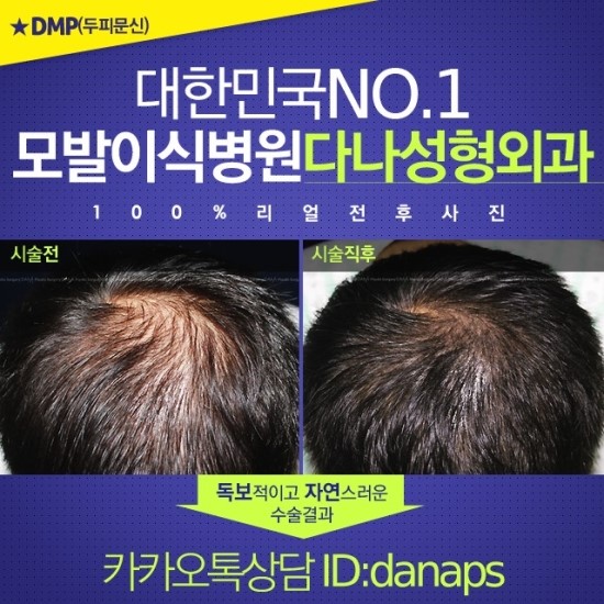 다나두피 이미지