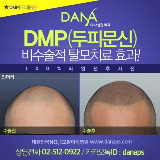 다나두피 이미지