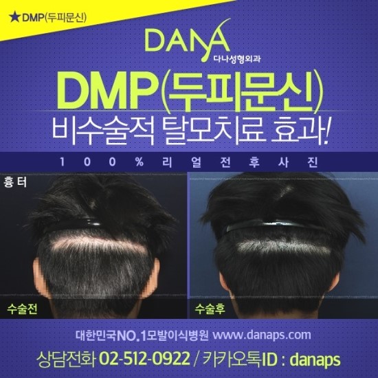 다나두피 이미지
