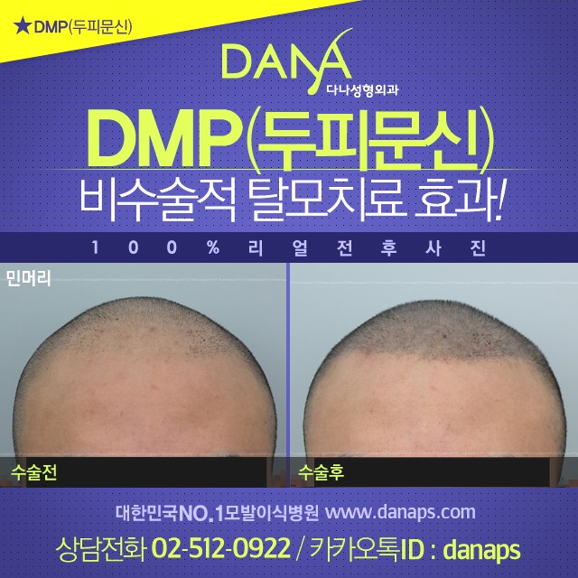다나두피 이미지