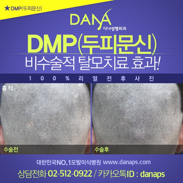 다나두피 이미지