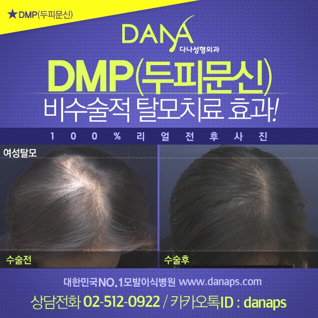 다나두피 이미지
