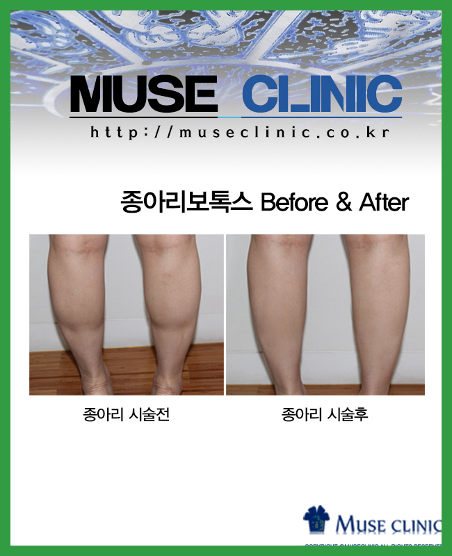 情이가네 이미지