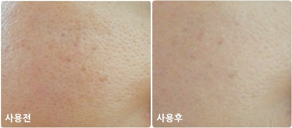 퓨어민 이미지