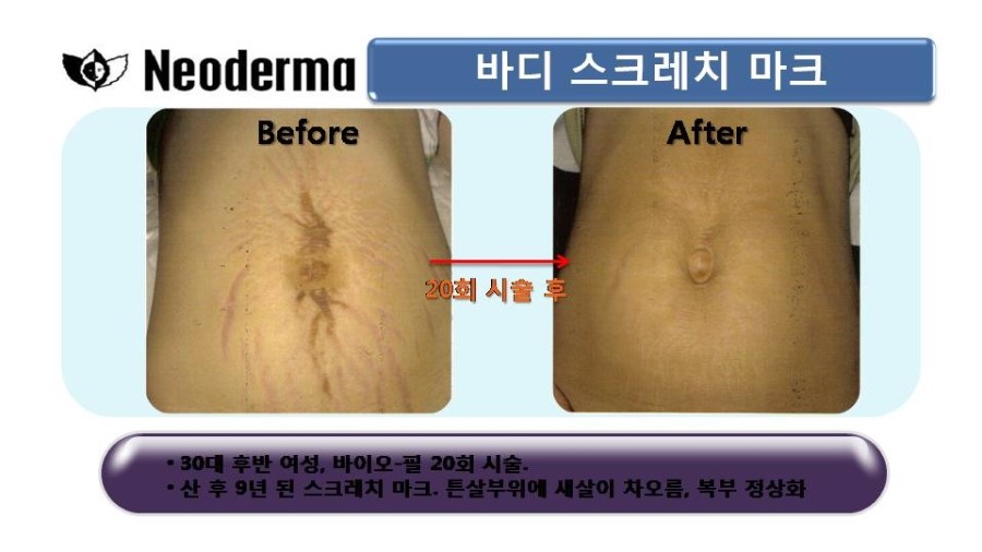 제이스킨 앤 바디 이미지