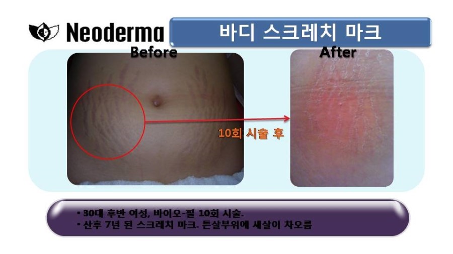 제이스킨 앤 바디 이미지