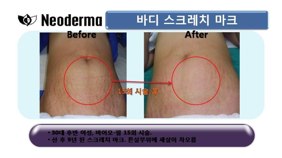 제이스킨 앤 바디 이미지
