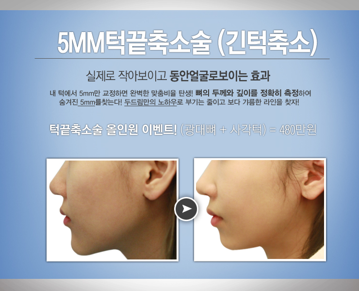 두드림경락 이미지