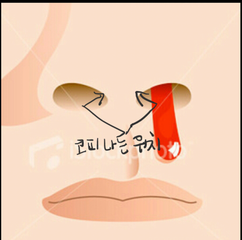 코피 멈추는 방법 : 네이버 블로그