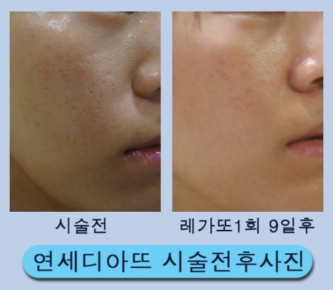 레가토 이미지